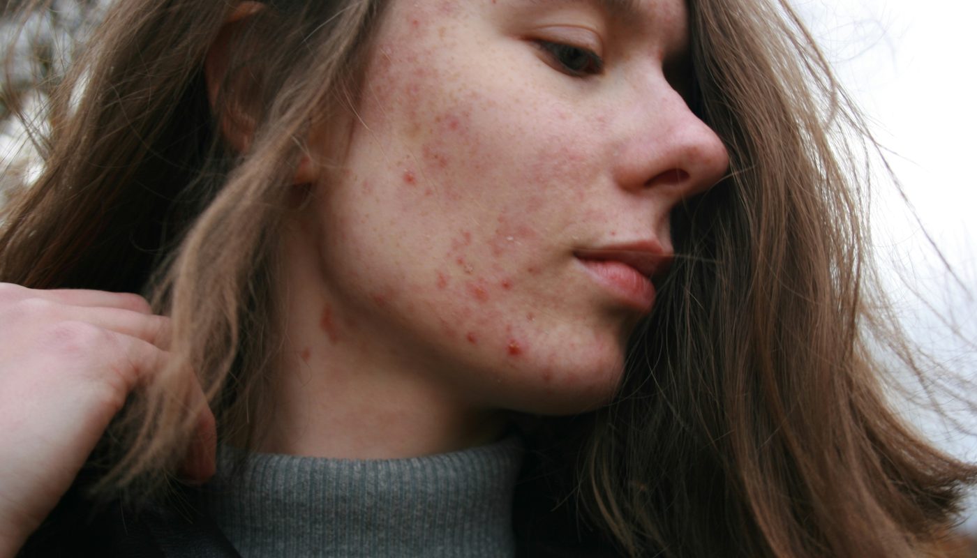 How do I know if my Skincare is working
